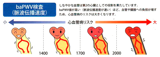 “動脈硬化”とは？